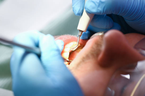 Best Tooth Pain Emergency Relief  in Nashvle, IL